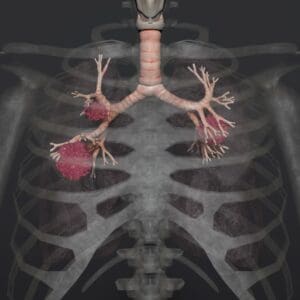 asbestos awareness xray