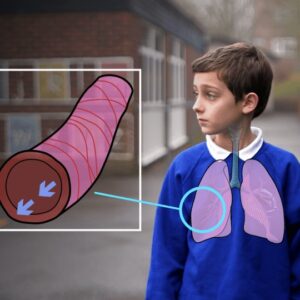 Asthma Training for Schools & Carers