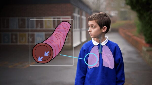 Asthma Training for Schools & Carers