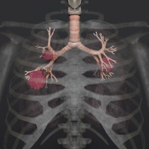 Asbestos Awareness (+International)